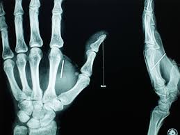 Arrt Rad Tech Premium Question Library