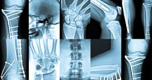 Rad Tech Exam Full-Length Practice Tests