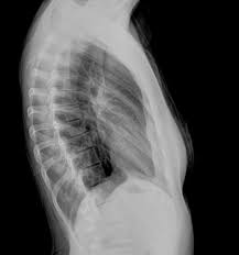 Rad Tech Exam Online Question Packs